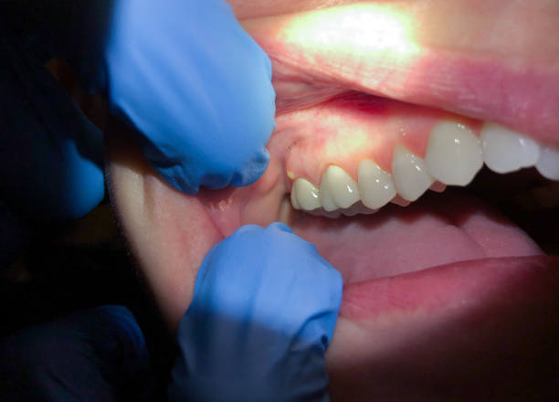 Best Urgent Care for Lost Fillings or Crowns in Twin Lakes, VA